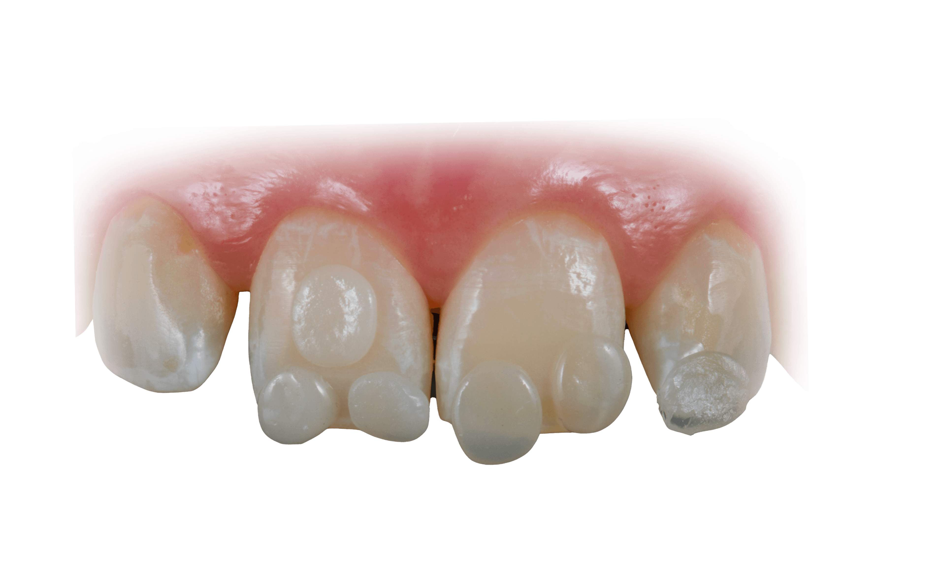 Técnica Restauradora